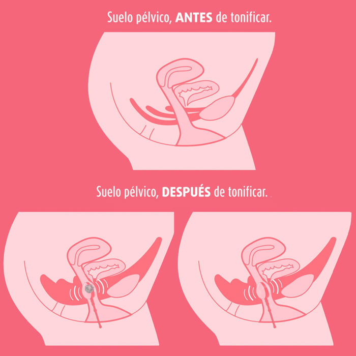 ENNA PELVIC BALL  1 UNIDAD - Imagen 3